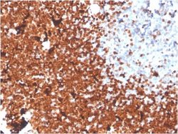 TdT Antibody (DNTT/1453) - Azide and BSA Free, Novus Biologicals 100 &mu;g | Buy Online | Novus Biologicals | Fisher Scientific